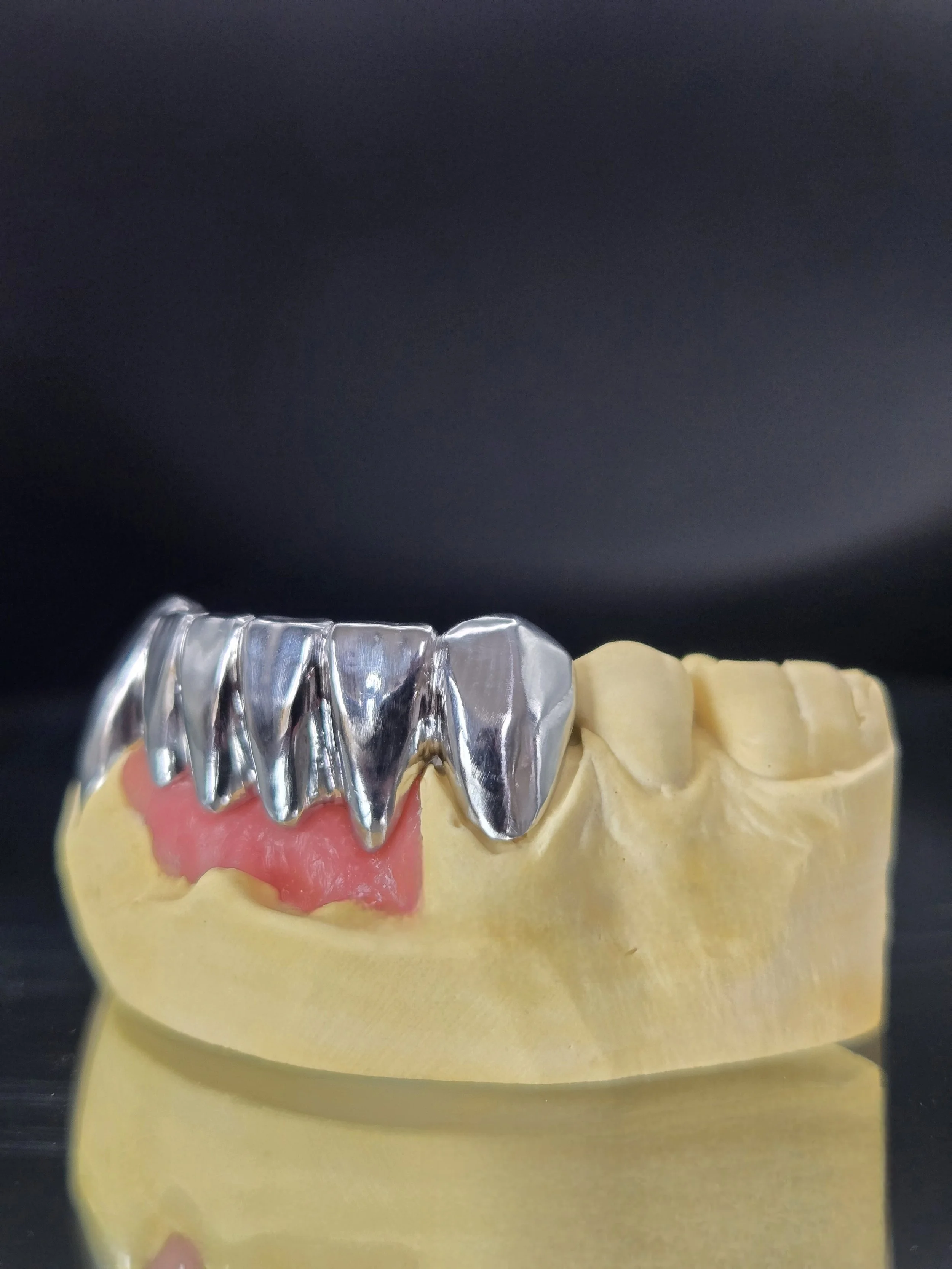 High-Noble_Milled_Anterior_Gold_Bridge_Right_View.jpg
