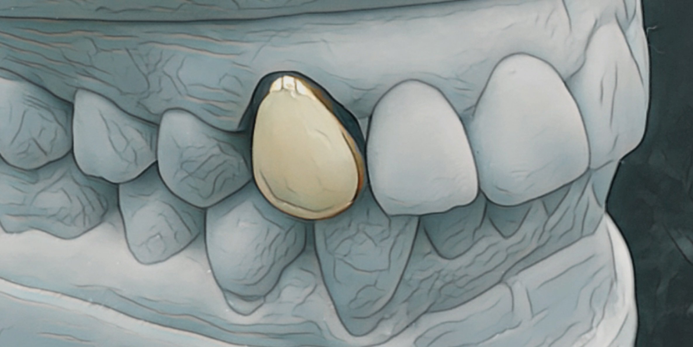 Close-up of human teeth with one tooth highlighted in yellow.