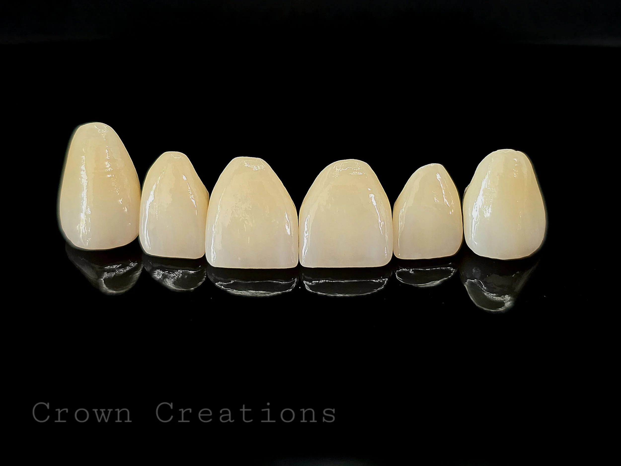Anterior_Full_Contour_Zirconia_Black_Background_1.jpg
