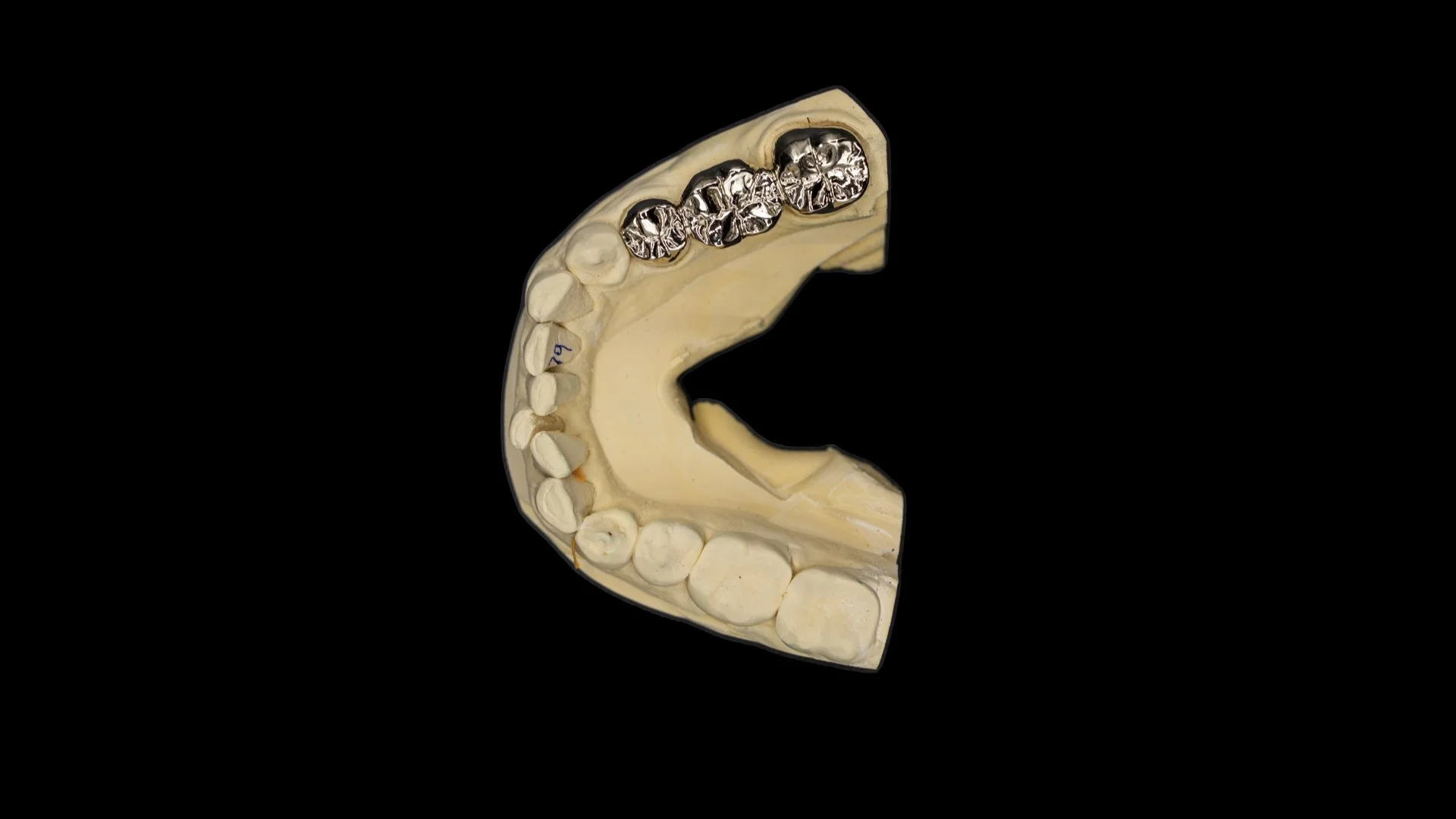 Gold_Bridge_High_Noble_Posterior_2.jpg