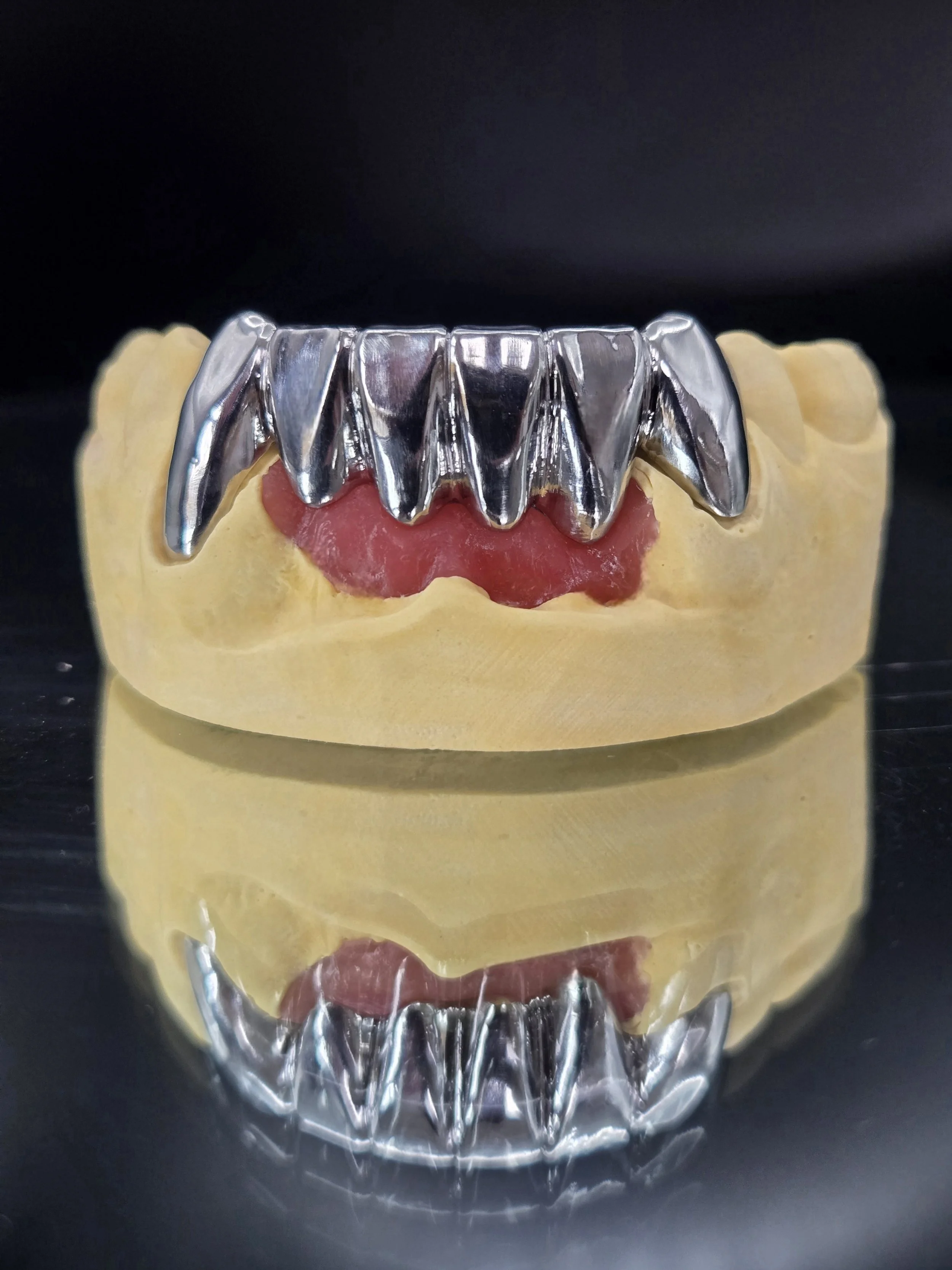 High-Noble_Milled_Anterior_Gold_Bridge_Front_View_2.jpg