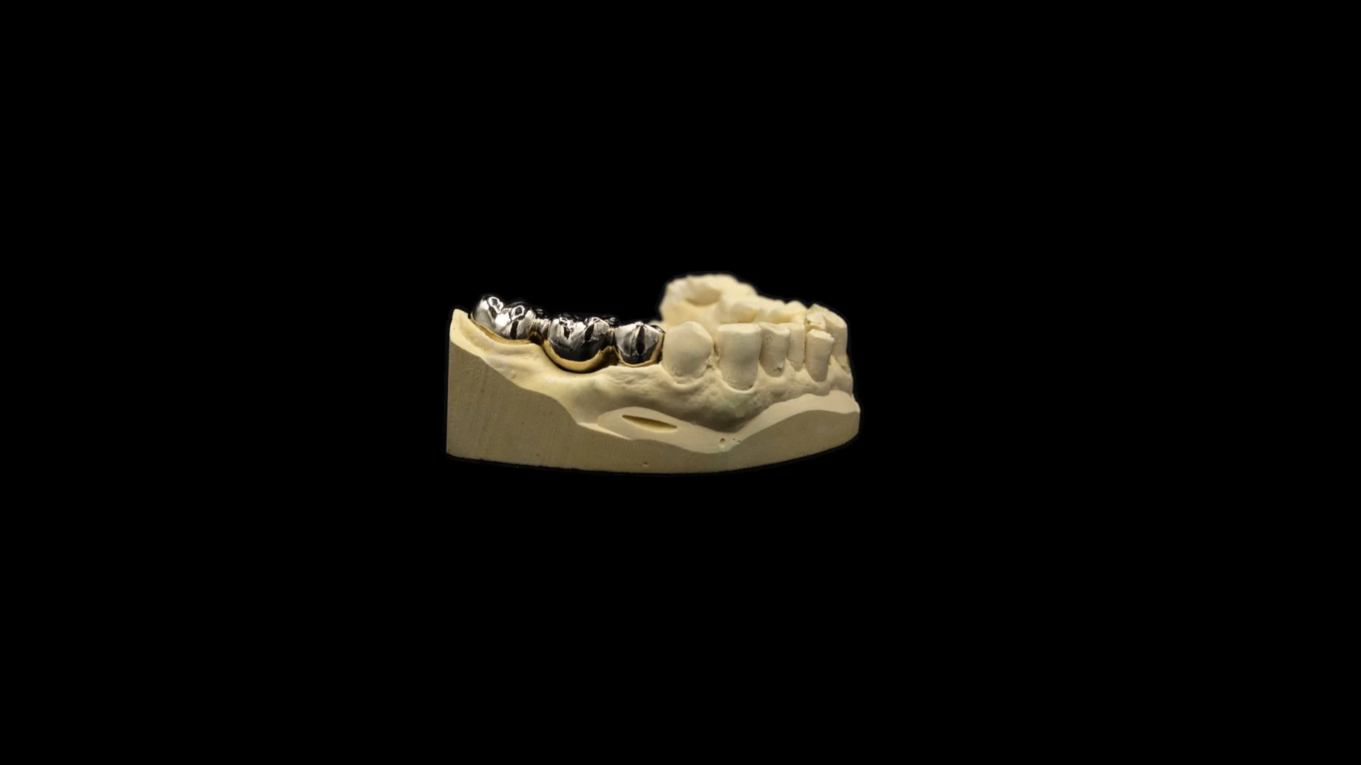 Gold_Bridge_High_Noble_Posterior_1.jpg