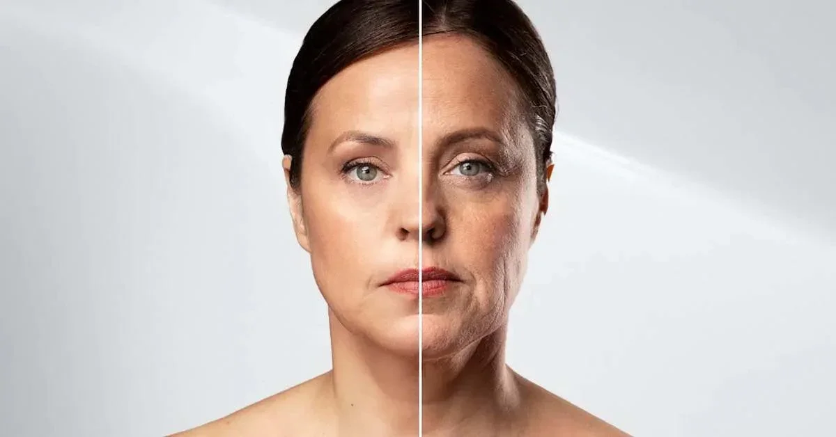 Collagen Loss