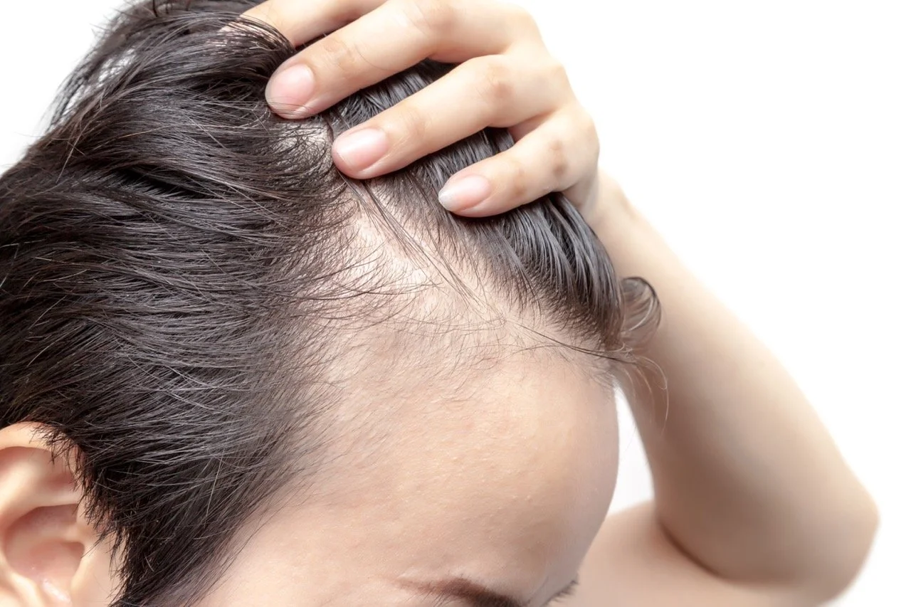 The Scalp Clinic
