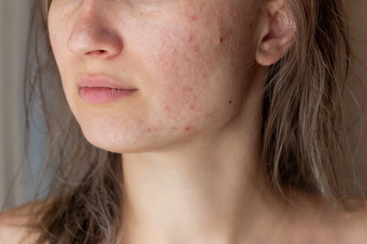 Skin Clinic