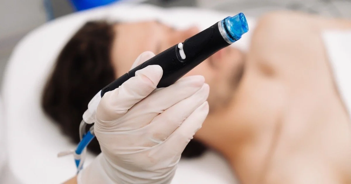 Hydrafacial Scalp