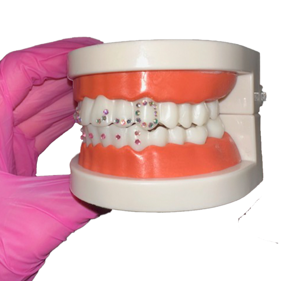 Dental model with teeth, some decorated with colorful rhinestones, held by a person wearing pink gloves.