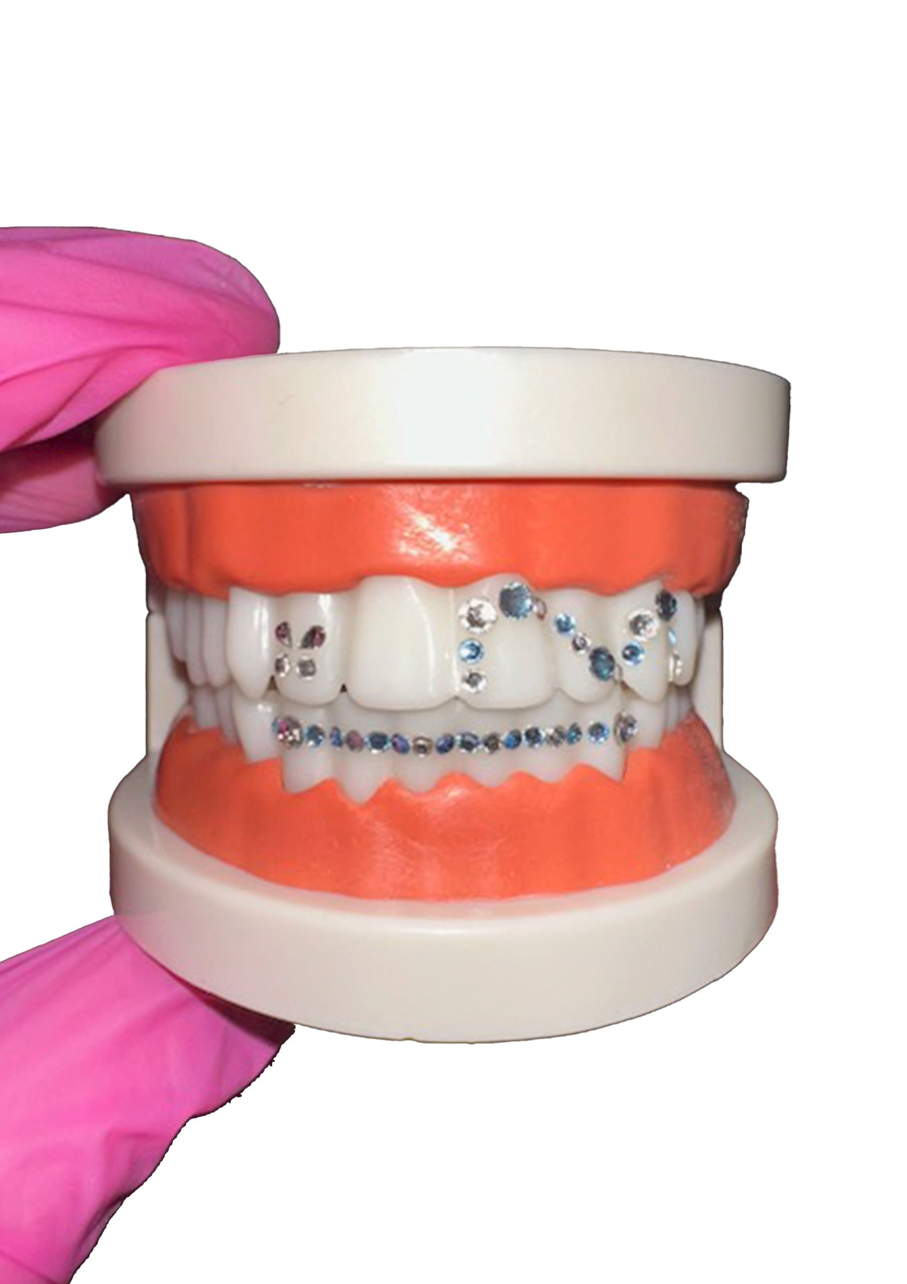 A dental model with dentures decorated with rhinestones, held by a person wearing pink gloves.