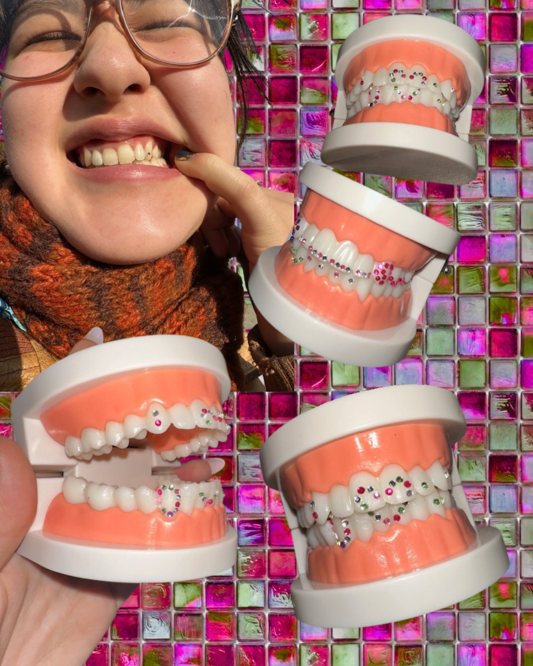 A person with glasses and a colorful scarf smiling and pointing at their teeth model, with several dental models decorated with small, colorful beads, against a pink and green tiled background.