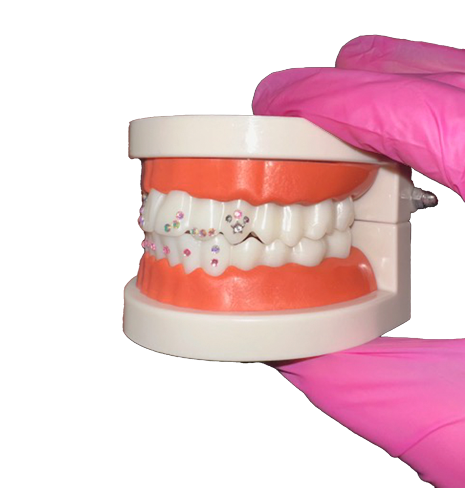 A dental model with teeth and gums, being held by a hand in a pink glove, against a black background.