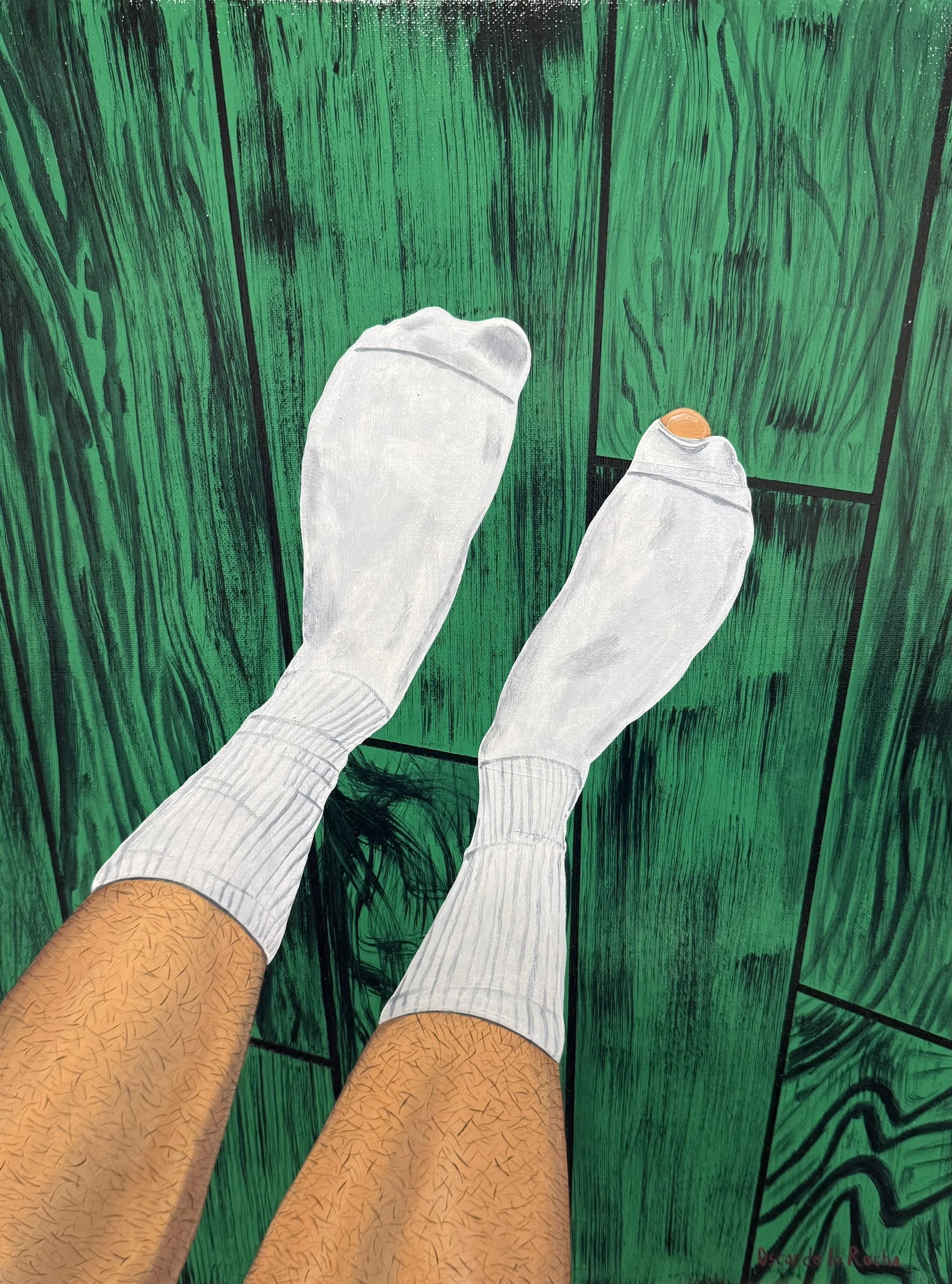 Hole in Sock on Green