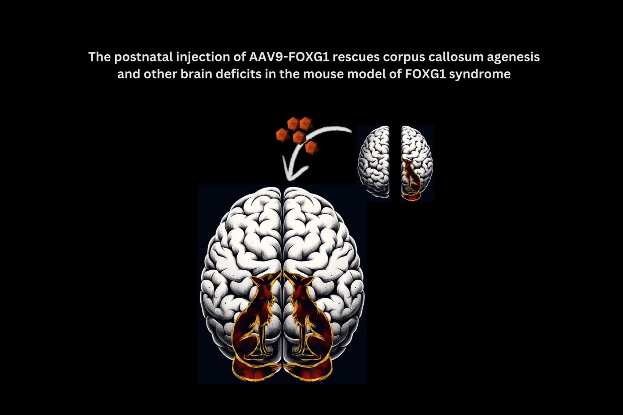 Groundbreaking FOXG1 AAV9 gene therapy studies; rescuing structural brain abnormalities