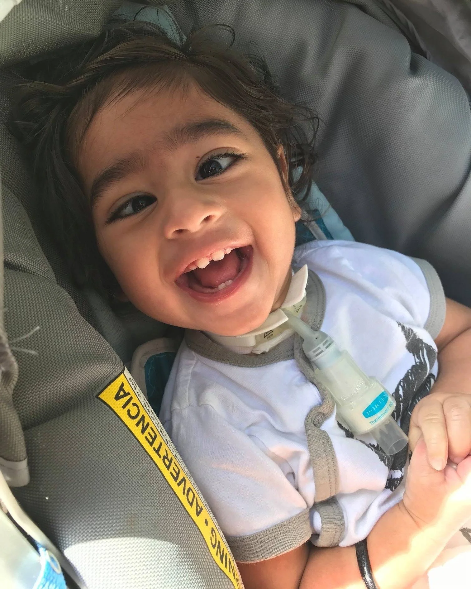 A smiling toddler with dark hair lying in a car seat, wearing a white shirt and a medical device around the neck.