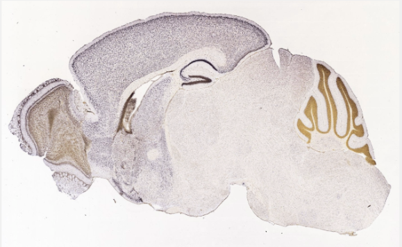 FOXG1 expression in human brain