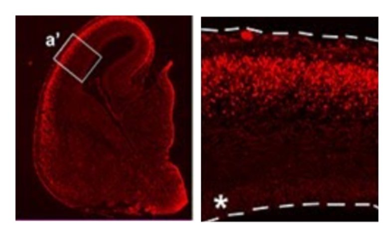 Microscopic image displaying a red-stained tissue sample, focusing on a specific area outlined and enlarged for detail.