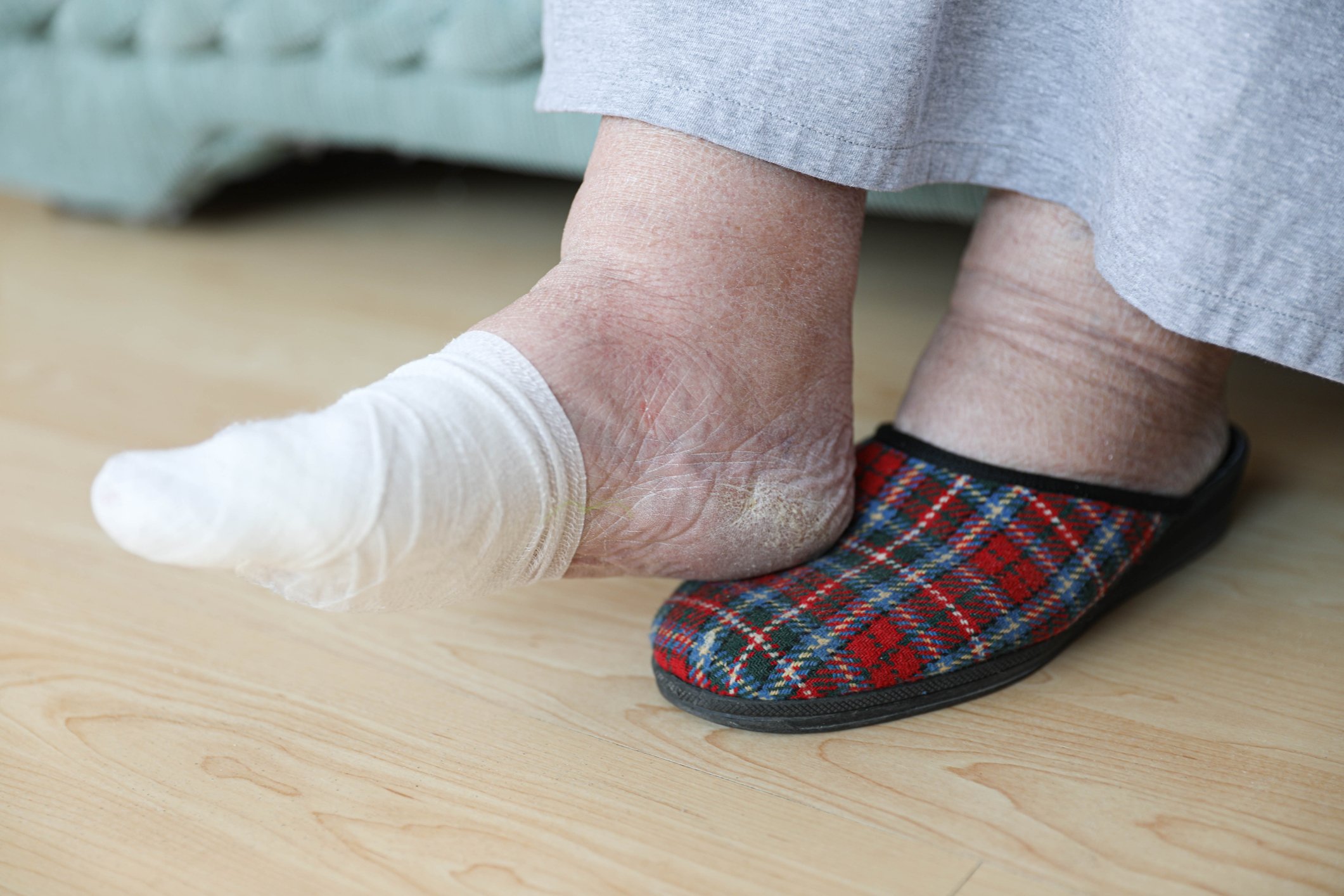 Close-up of an elderly person's foot with dry skin, wearing a white sock and a plaid slipper, resting on a wooden floor with a piece of furniture in the background.