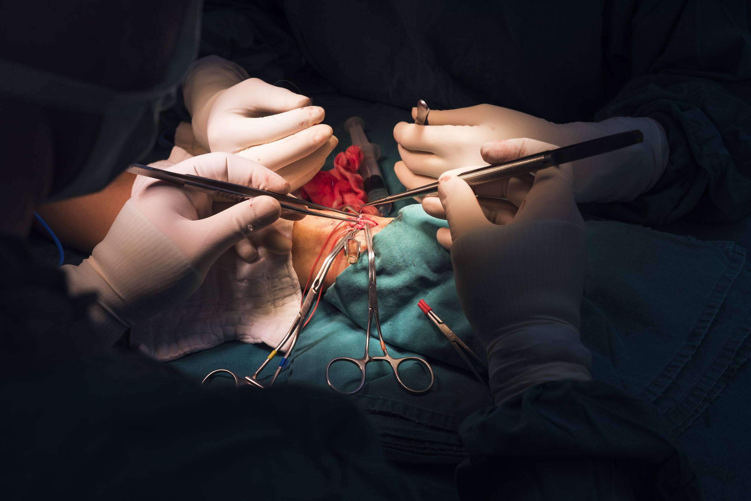 Surgeons performing an operation in an operating room with surgical tools.