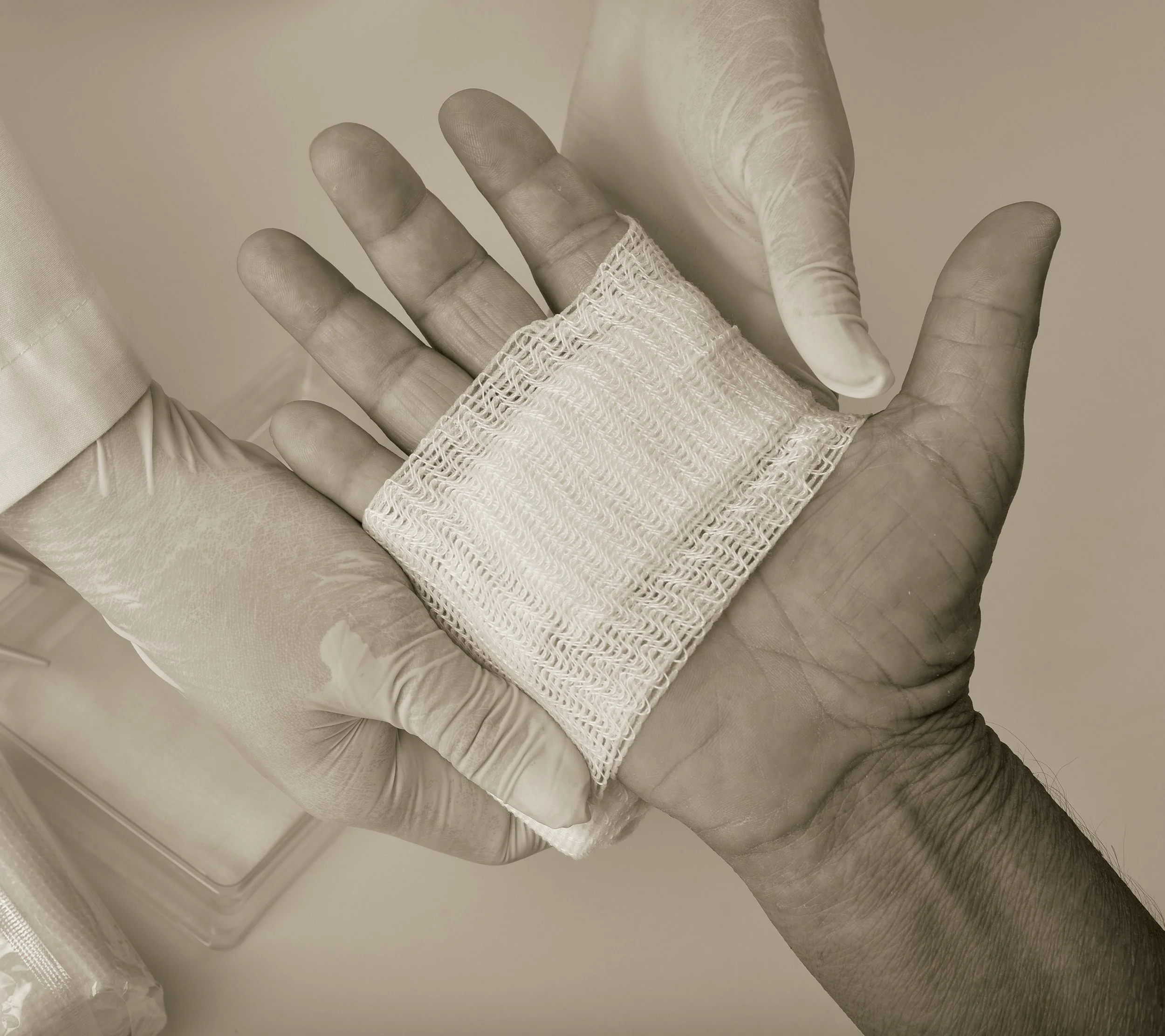 A person with dark skin wearing medical gloves shows their hand with a gauze bandage wrapped around the wrist.