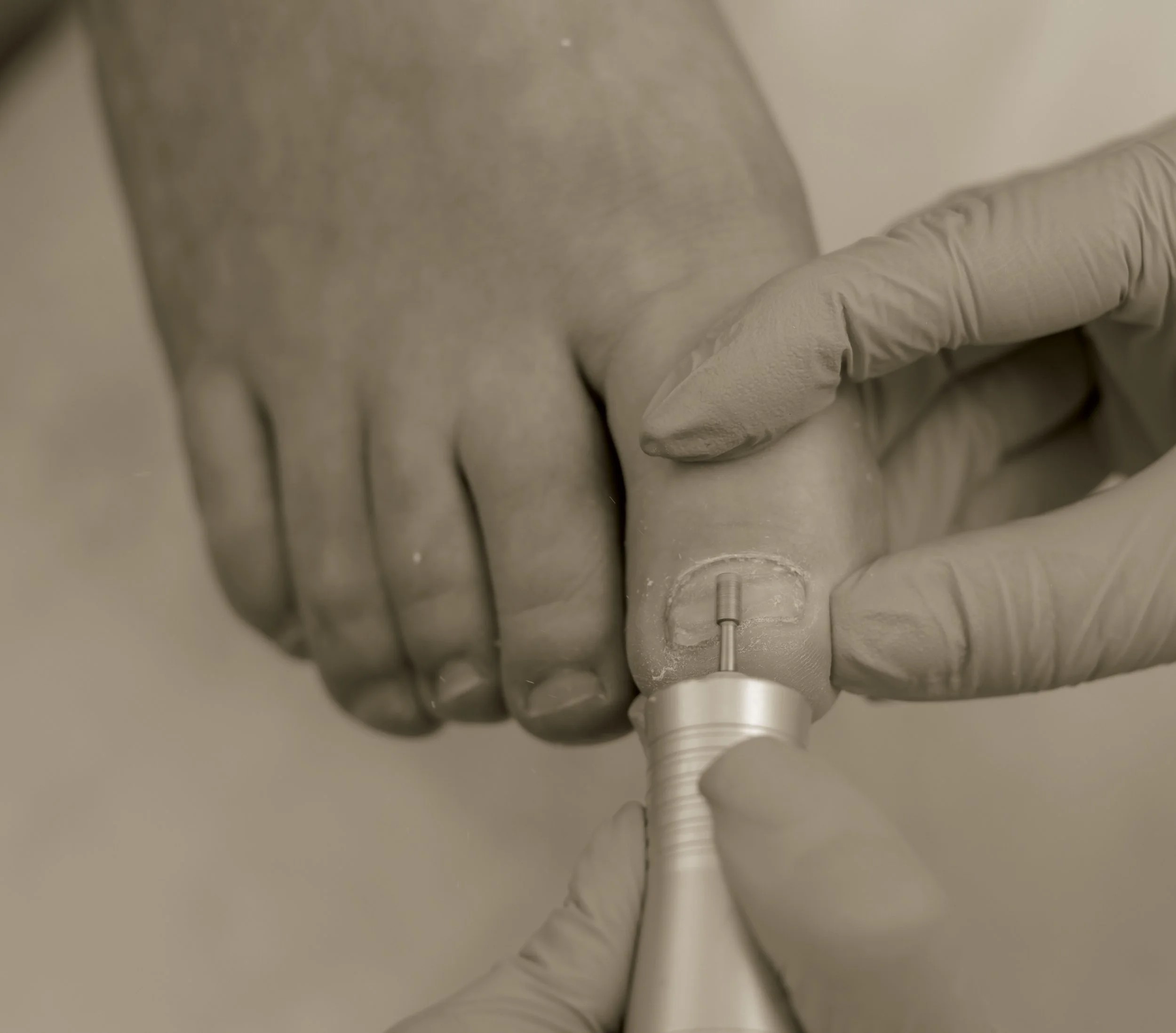 A close-up of a pedicure procedure where a person in gloves uses a tool to work on a toenail.