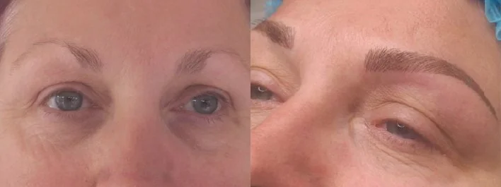 Deanne Perkins Advanced Eyebrow Correction.