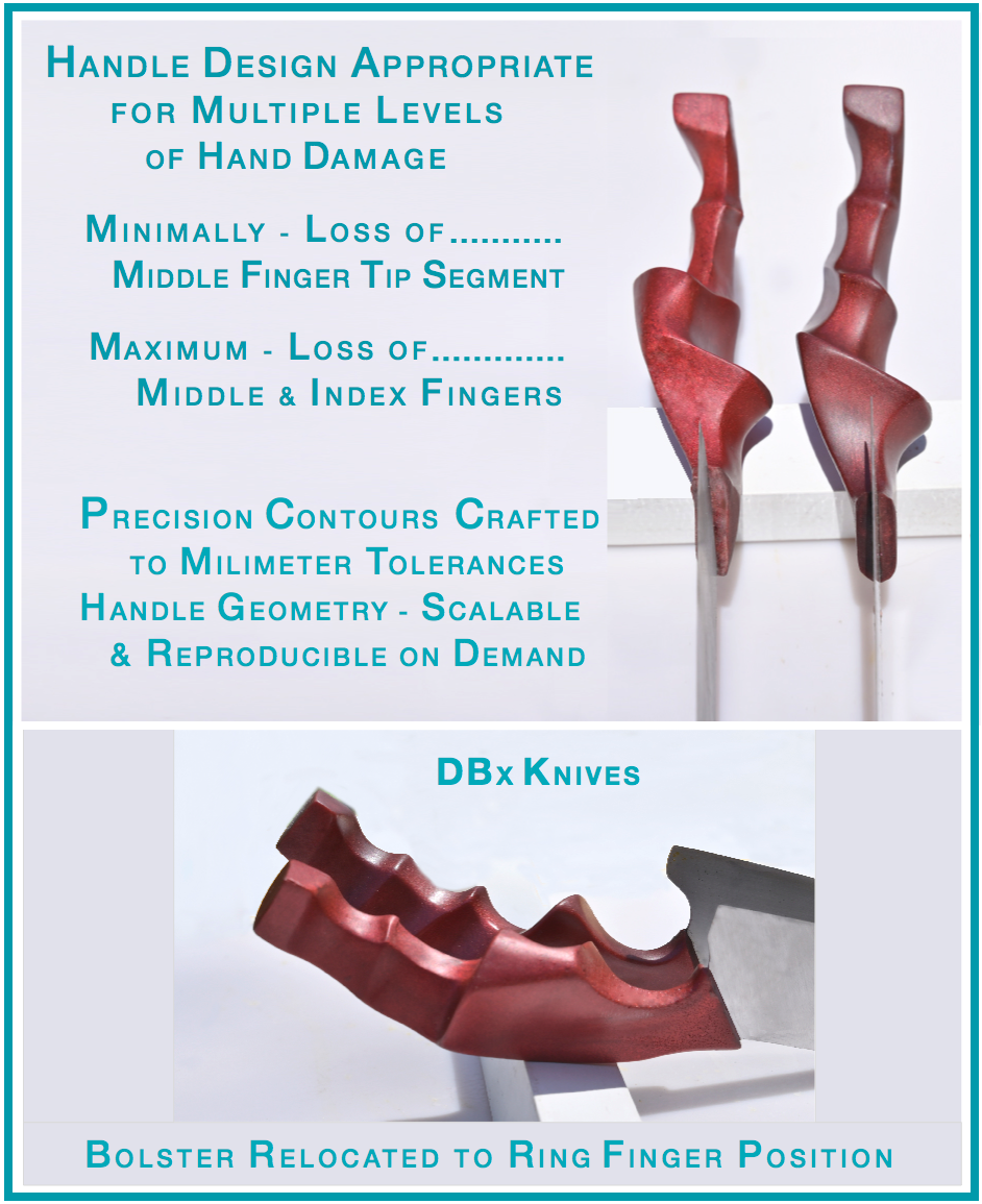 Photograph of DBx custom handles designed for traumatic amputation — accommodating partial middle finger tip loss through complete loss of index and middle fingers with precision contours reproducible from original tooling.