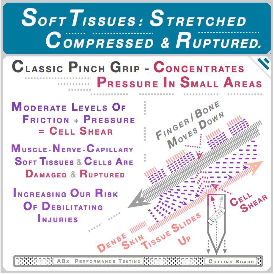 Classic pinch-grip concentrates pressure creating cell shear — moderate friction plus pressure ruptures muscle, nerve and capillary cells. Documented in pressure ulcer, trigger finger and carpal tunnel medical literature. ABx Performance Testing.