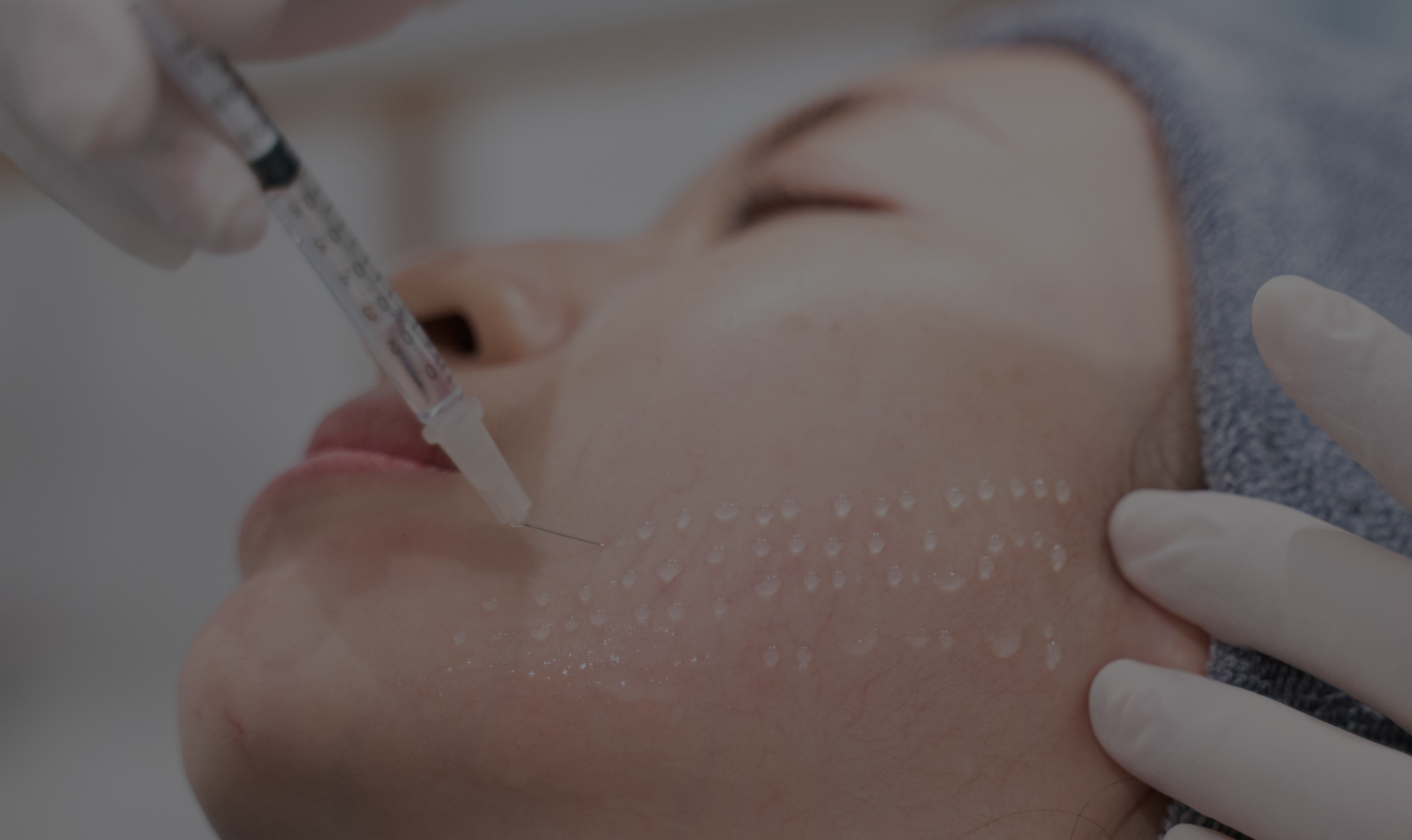 Medspa in Chicago, IL, 60661 | Mesotherapy Near Me