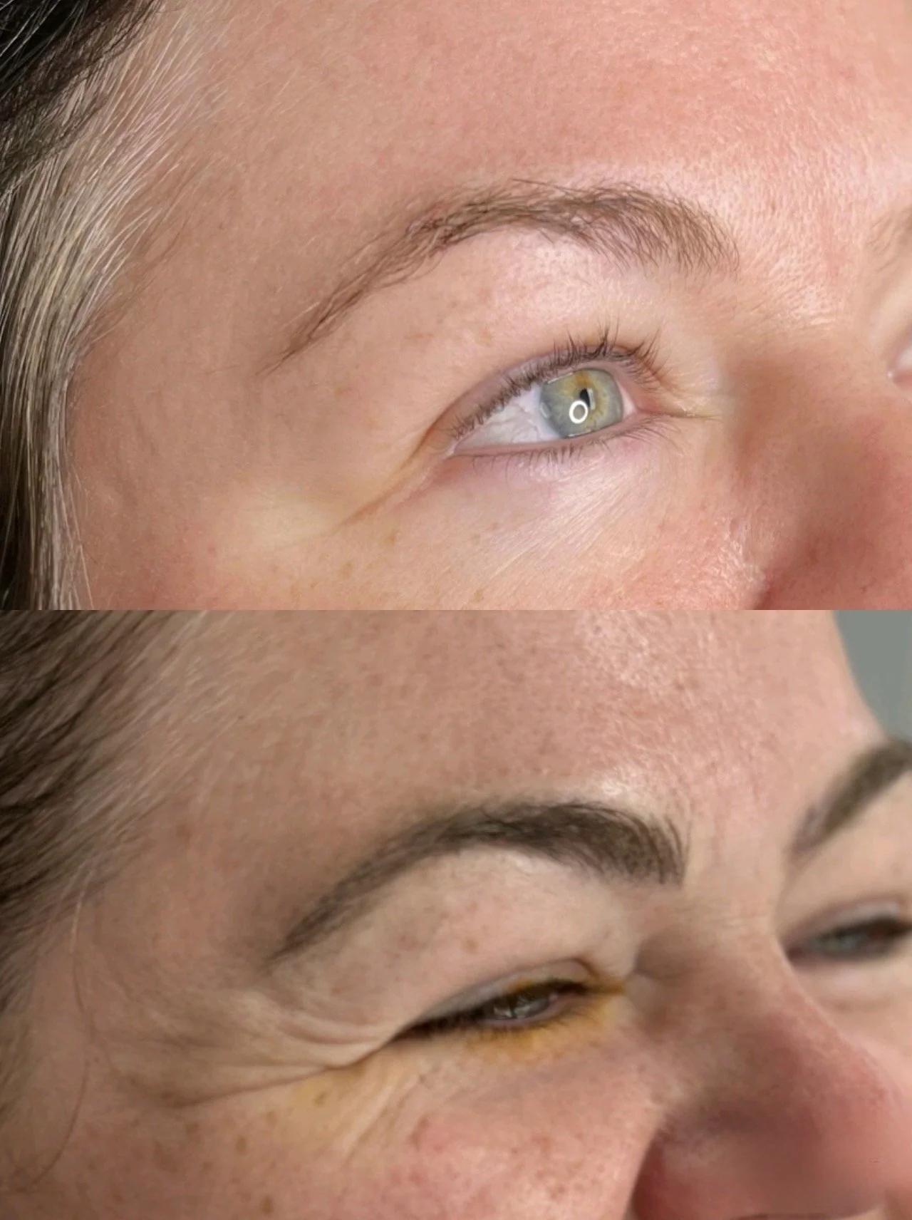Close-up of a woman's face, showing a before and after comparison of her eye area. The top image displays smooth skin with minimal wrinkles, while the bottom image shows wrinkles and fine lines around the eye.