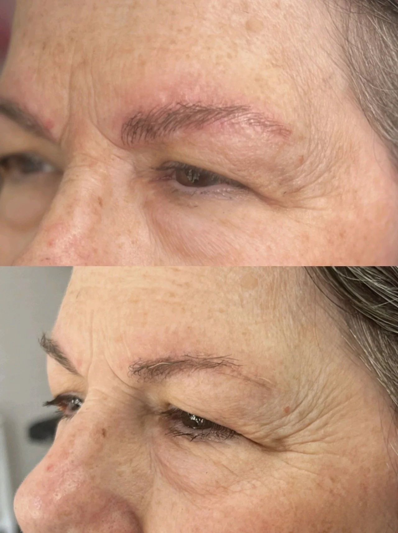 Close-up of a woman's face, showing a before-and-after comparison of her eye area with improvements in skin texture and wrinkles.