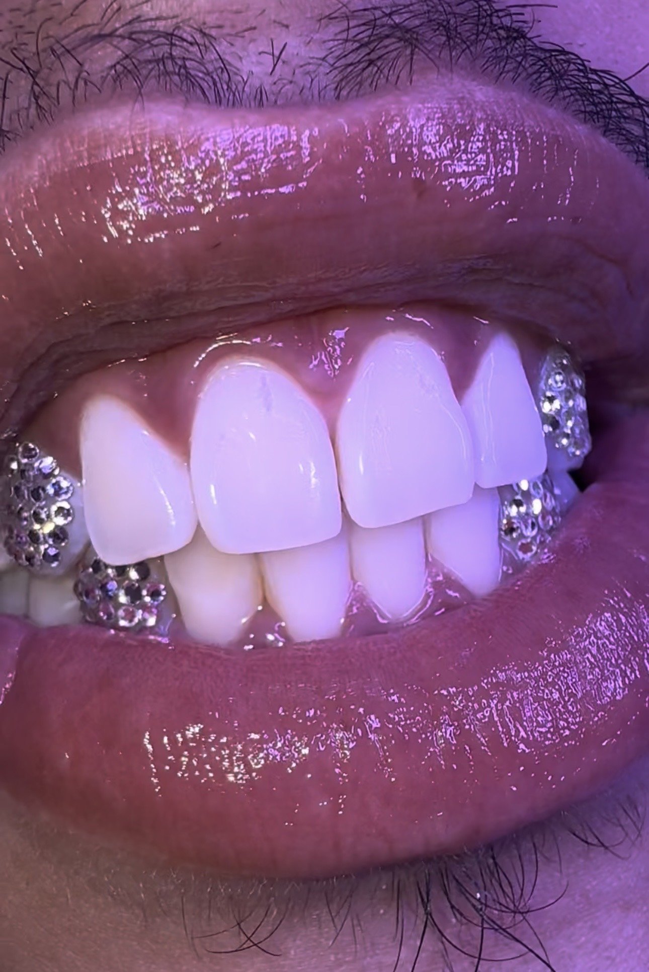 downey-tooth-gems-glimmer-grinz