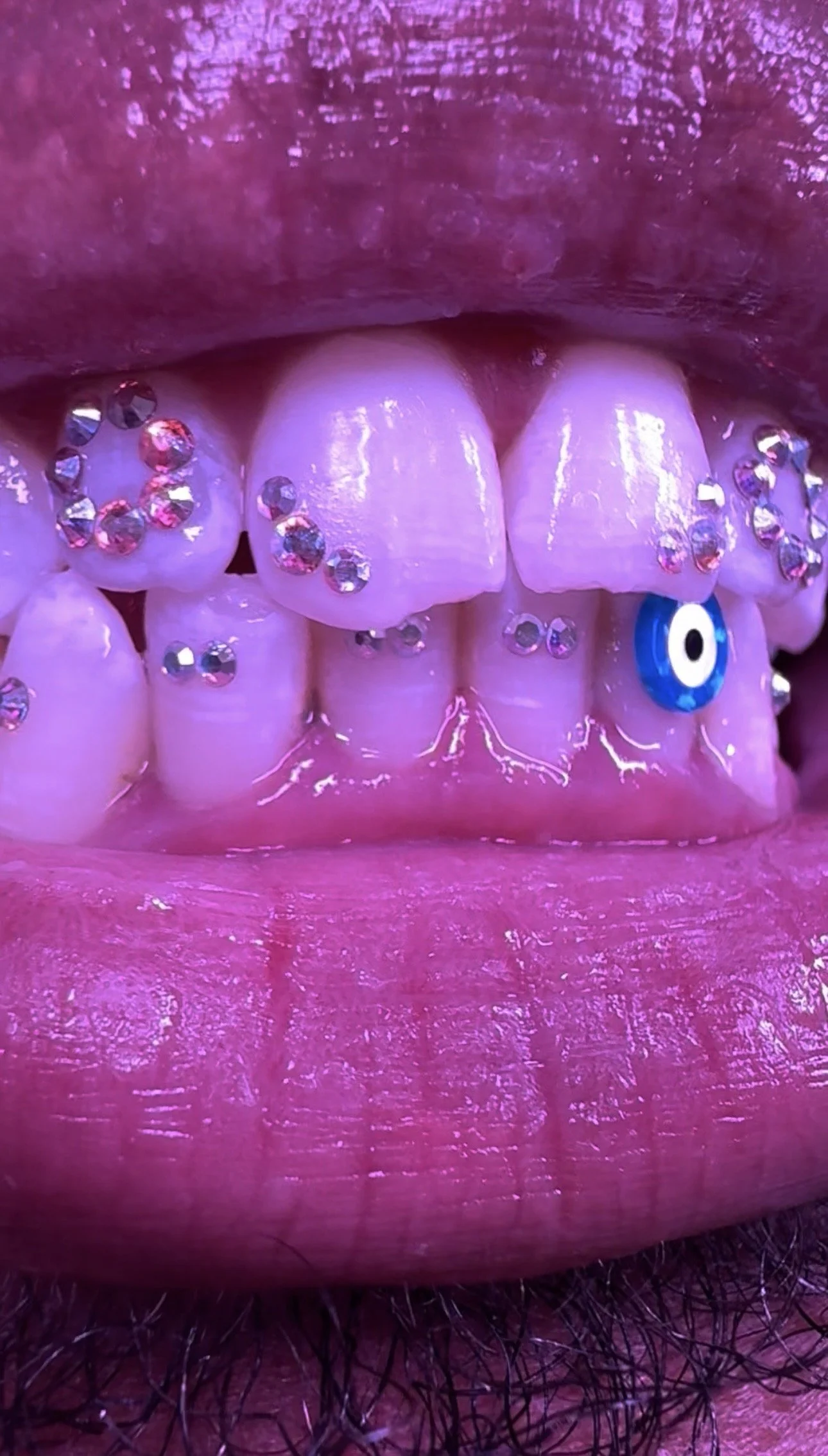 downey-tooth-gems-glimmer-grinz