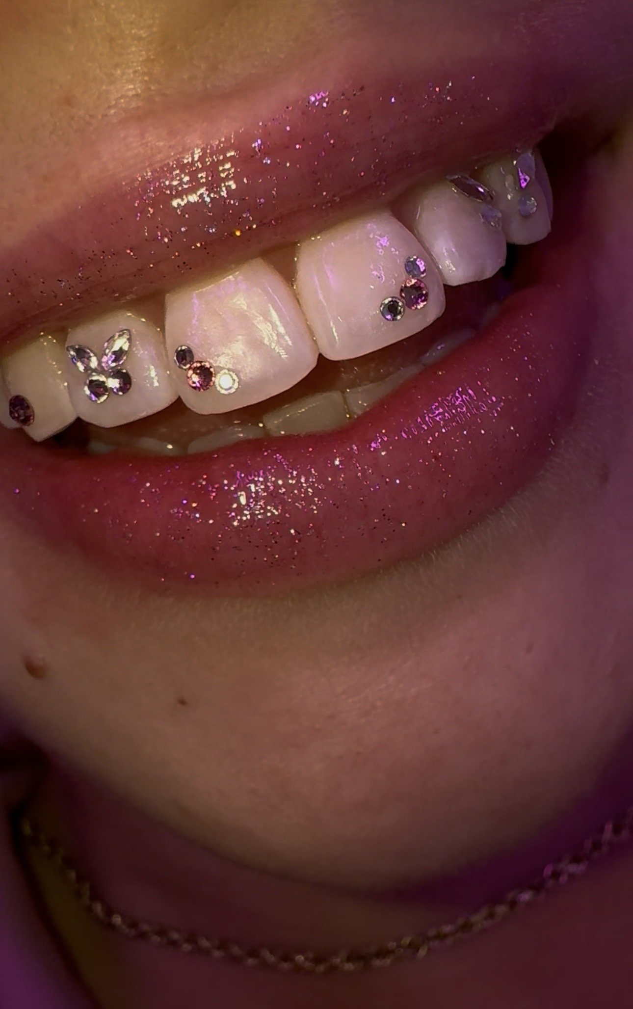 Close-up of a person's lips with pink glitter lipstick and rhinestones shaped like butterflies and circles on their teeth.