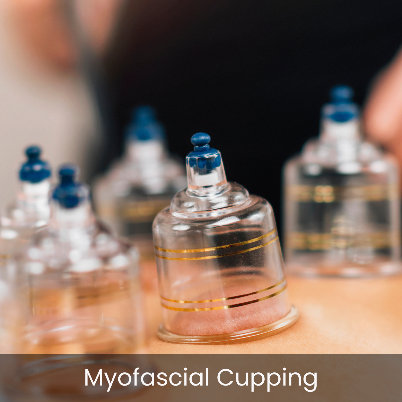 Close-up of transparent glass cups with blue and black silicone covers on a wooden surface, labeled 'Myofascial Cupping' at the bottom.