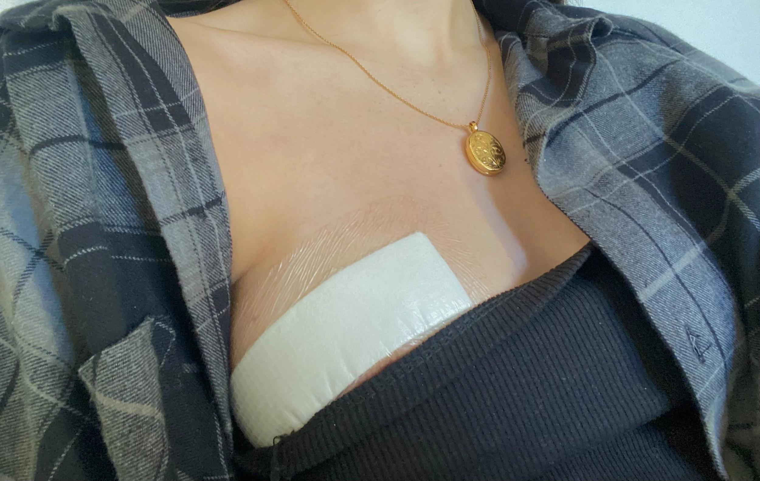 A woman wearing a plaid shirt with the top unbuttoned, revealing a gold necklace with a decorative oval pendant, black clothing, and a beige bandage on her chest.
