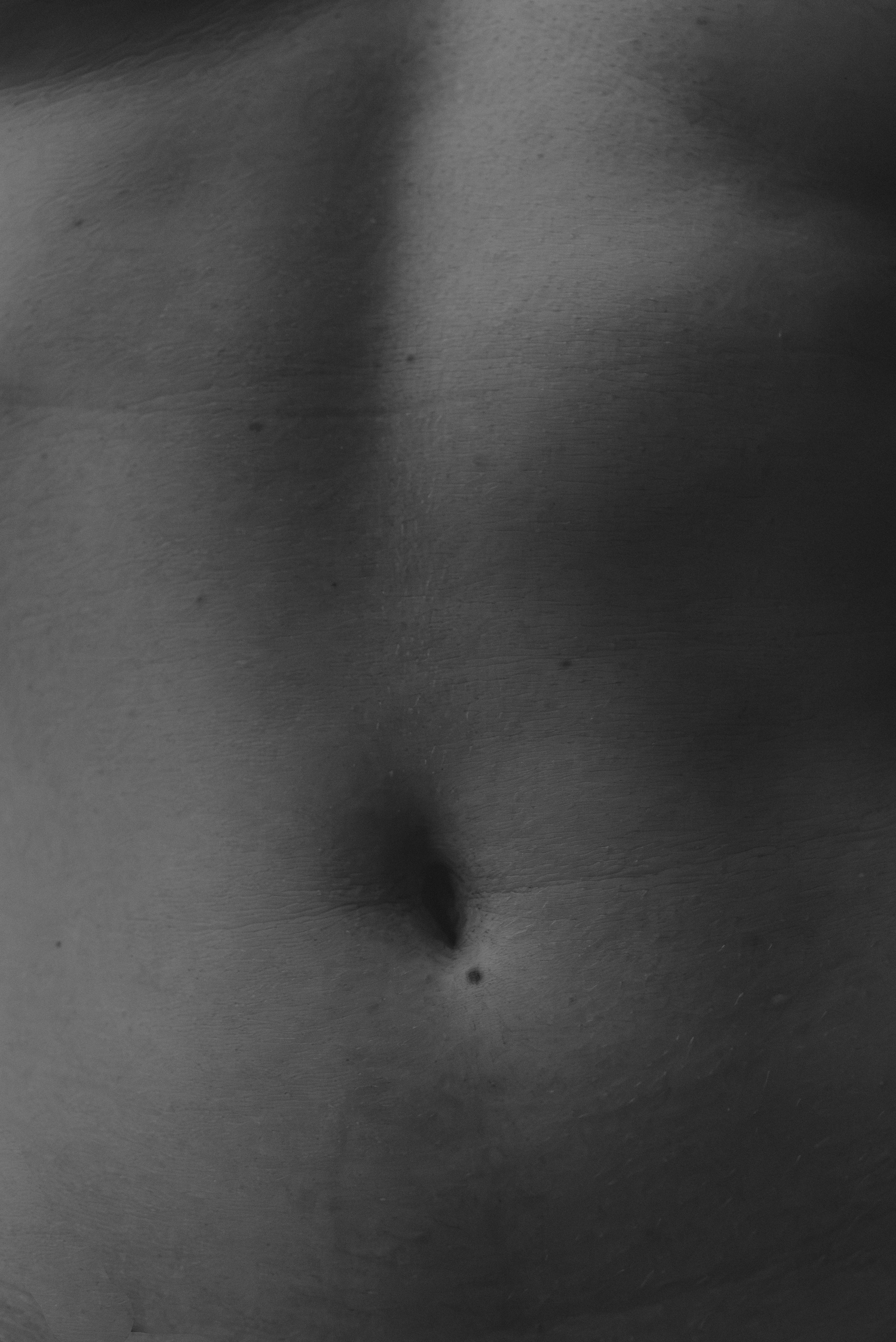 Close-up black-and-white photo of a person's nose and upper lip, with a bump on the skin.