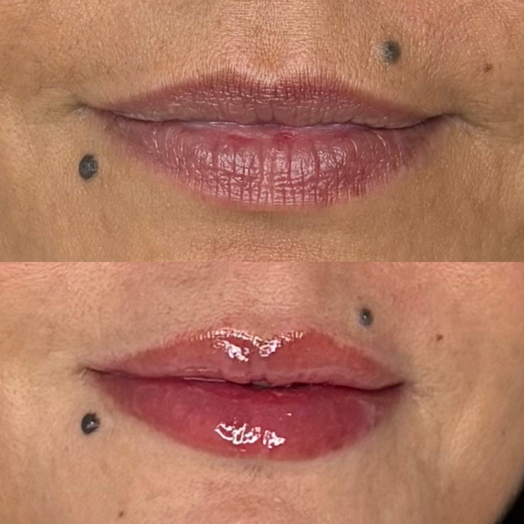 Close-up before and after lip blush showing corrected tone, refined shape, and enhanced natural colour