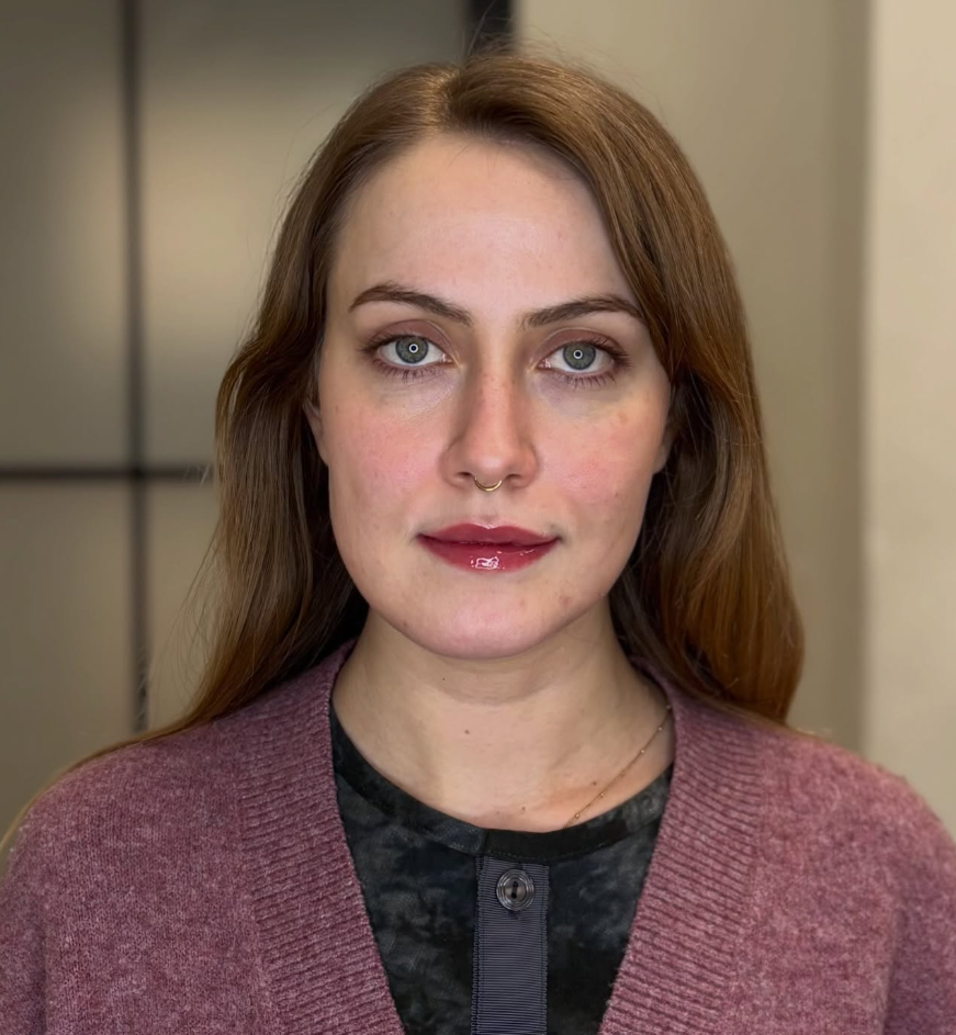 Fresh lip blush immediately after treatment, showing a soft, natural tint.