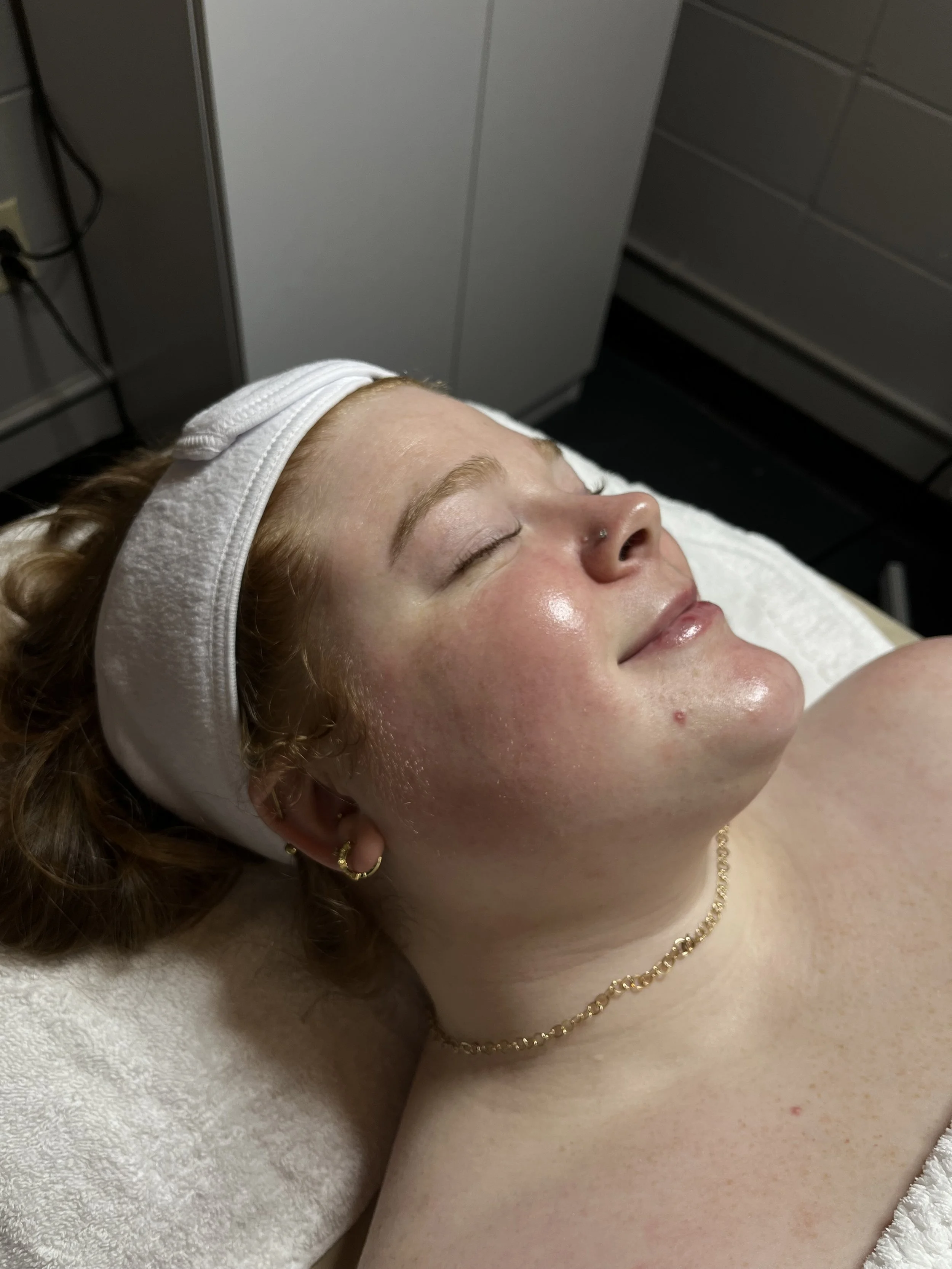 After the signature glow facial