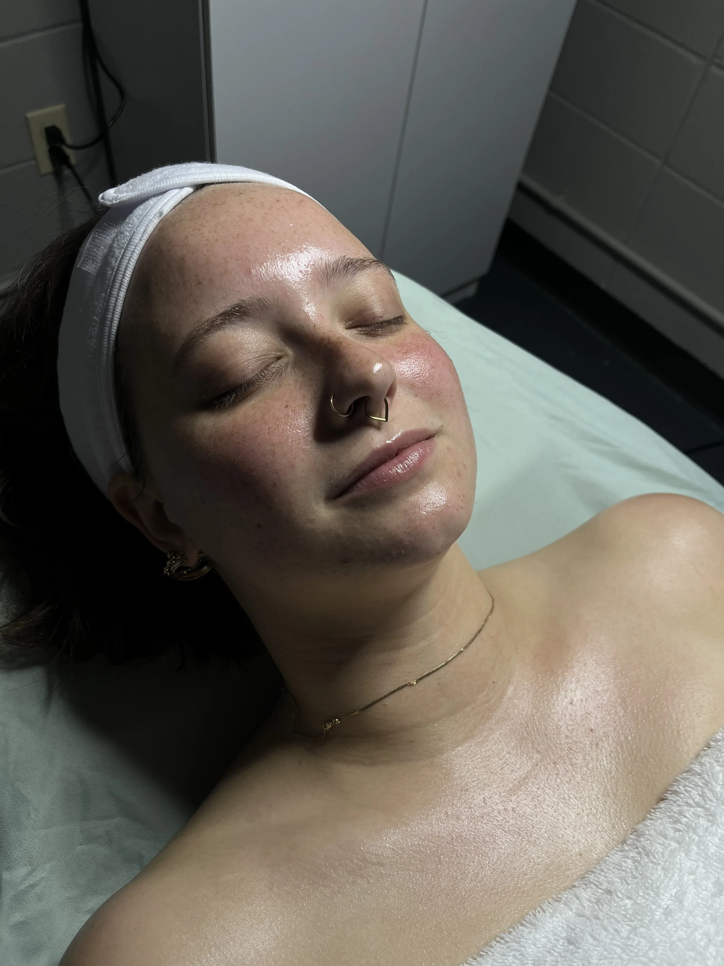 After the signature glow facial