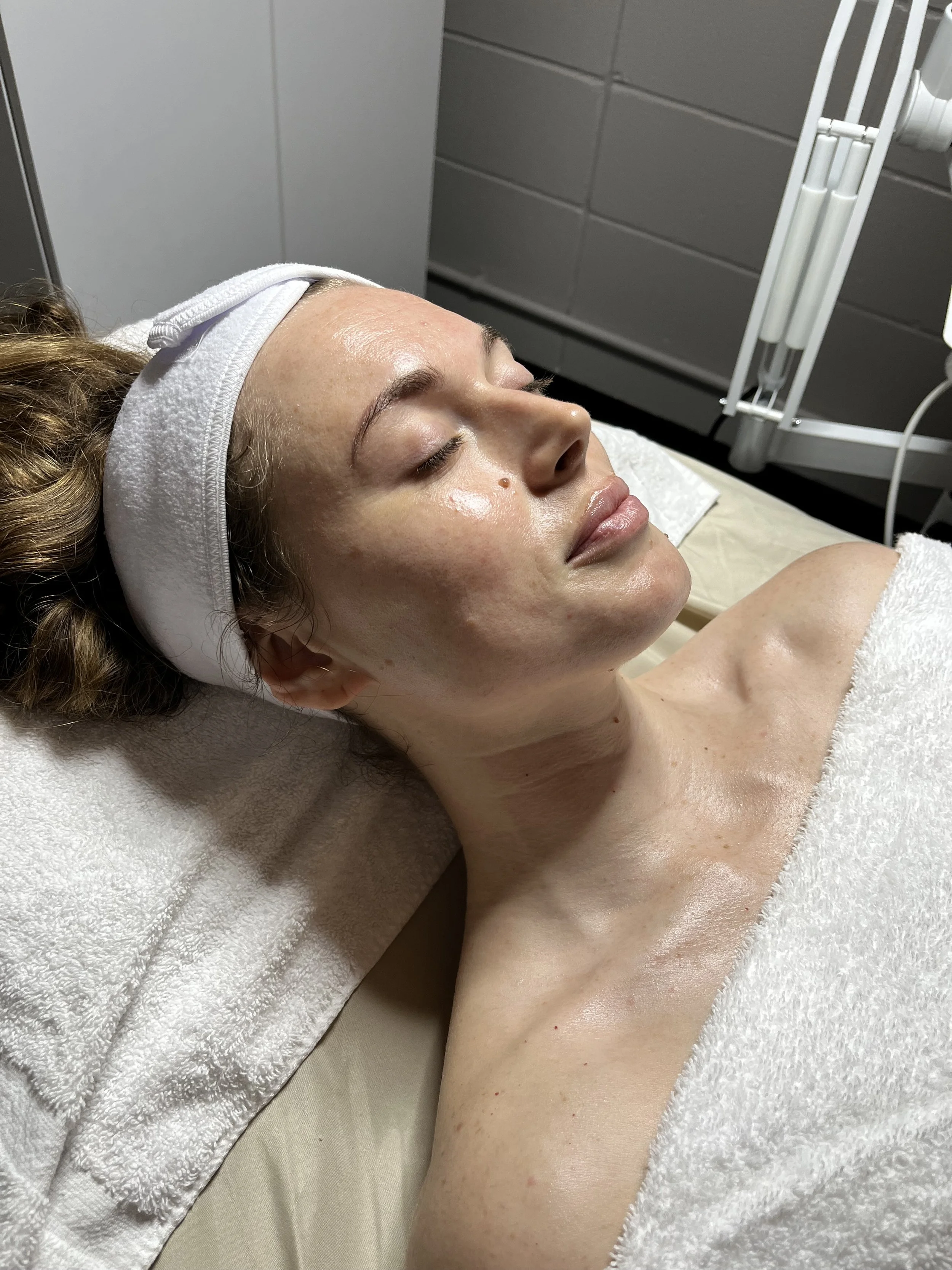 The glow after the dermaplane facial