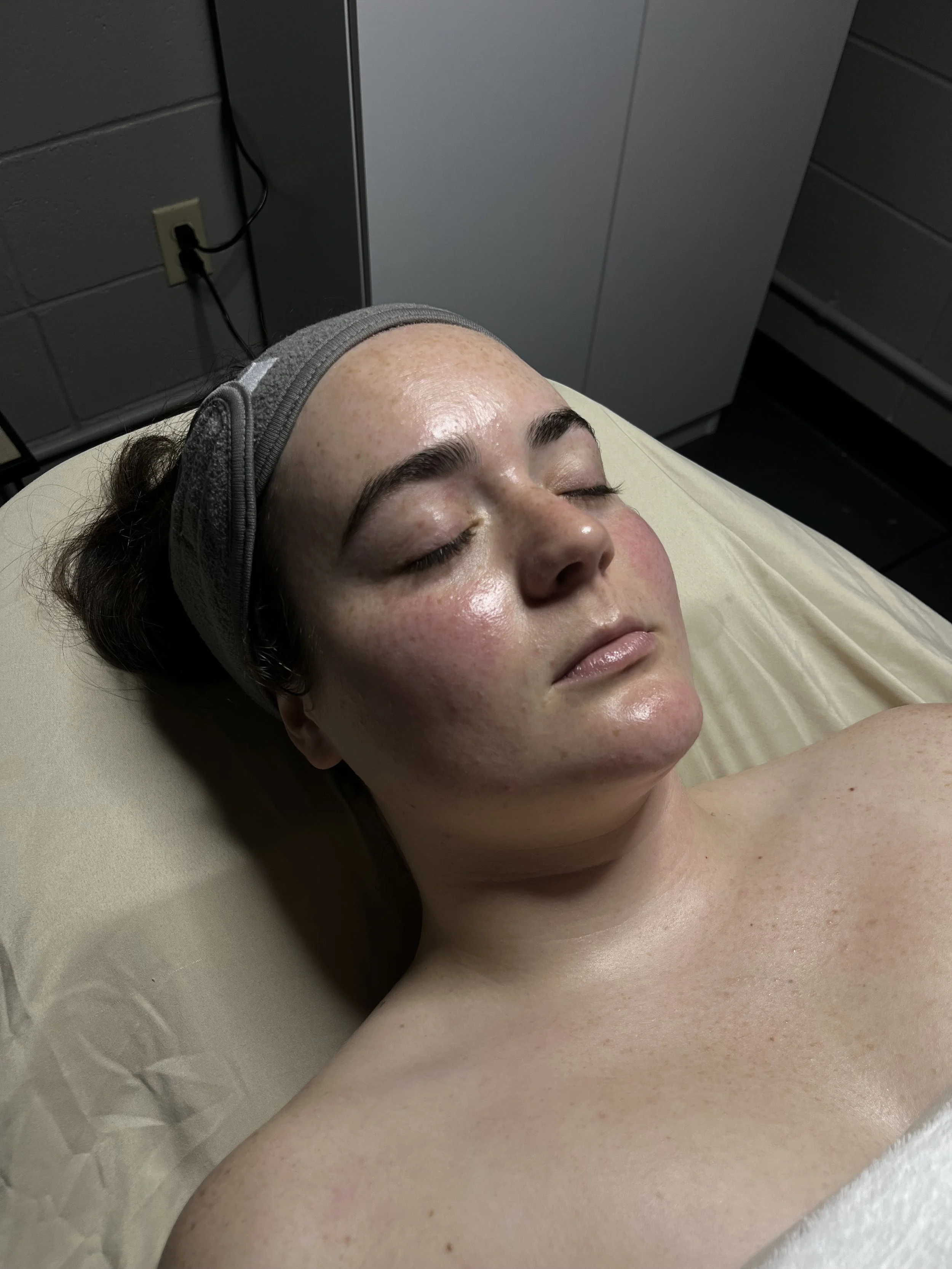 The glow after the dermaplane facial