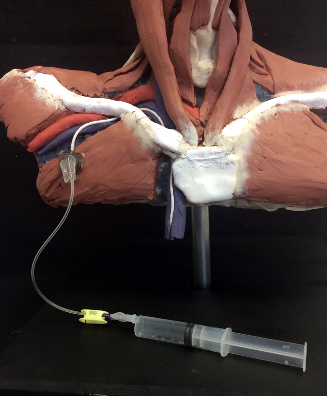 Anatomy Study- Port insertion