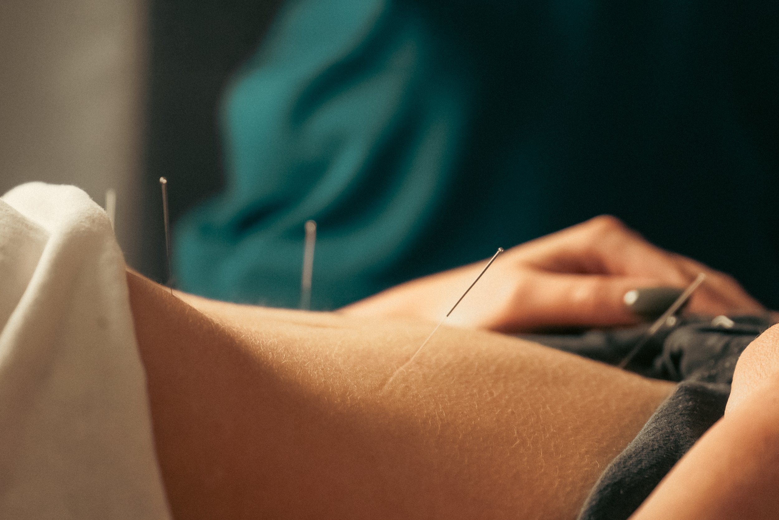 Acupuncture + IVF: How to Prep your Body