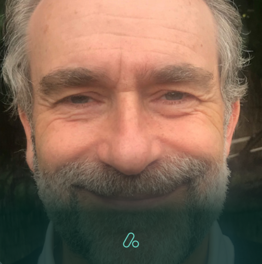 Finding digital solutions for multiple sclerosis and fatigue