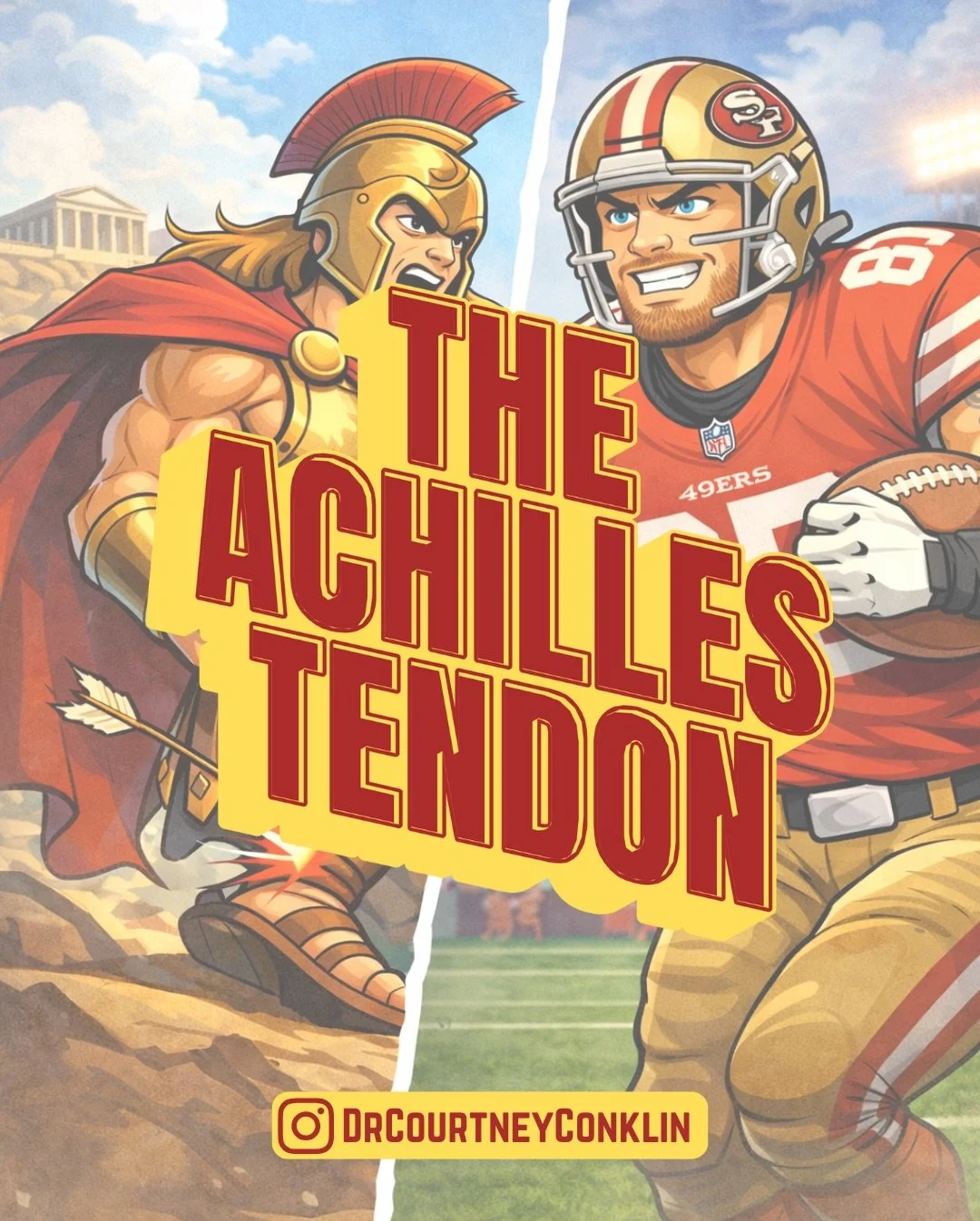 🏈👀 If you were watching yesterday&rsquo;s NFC Wild Card game between the 49ers and Eagles, you saw George Kittle suffer one of the most vulnerable and devastating injuries in sports - a ruptured Achilles tendon.

➡️ Swipe to learn more about the Ac