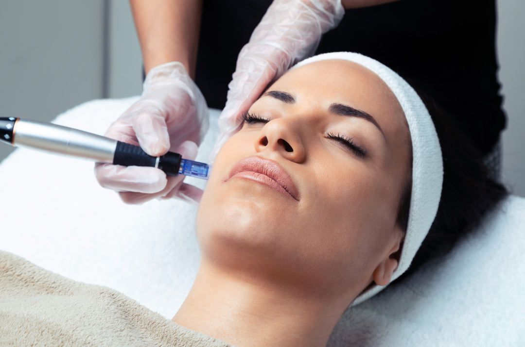 Medspa in Waskom, TX, 75692  Microneedling Near Me