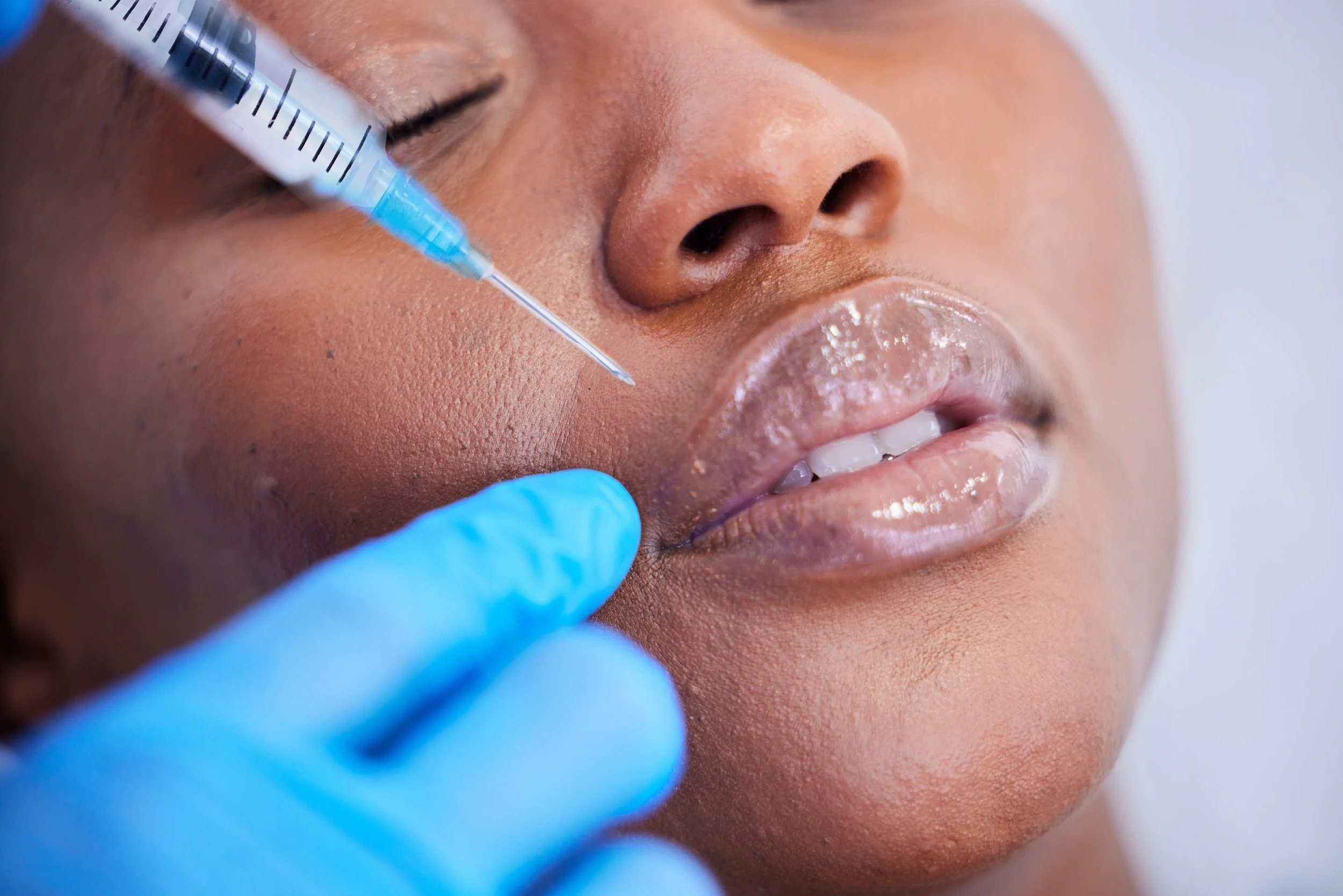 Medspa in Waskom, TX, 75692  Fillers Near Me.png