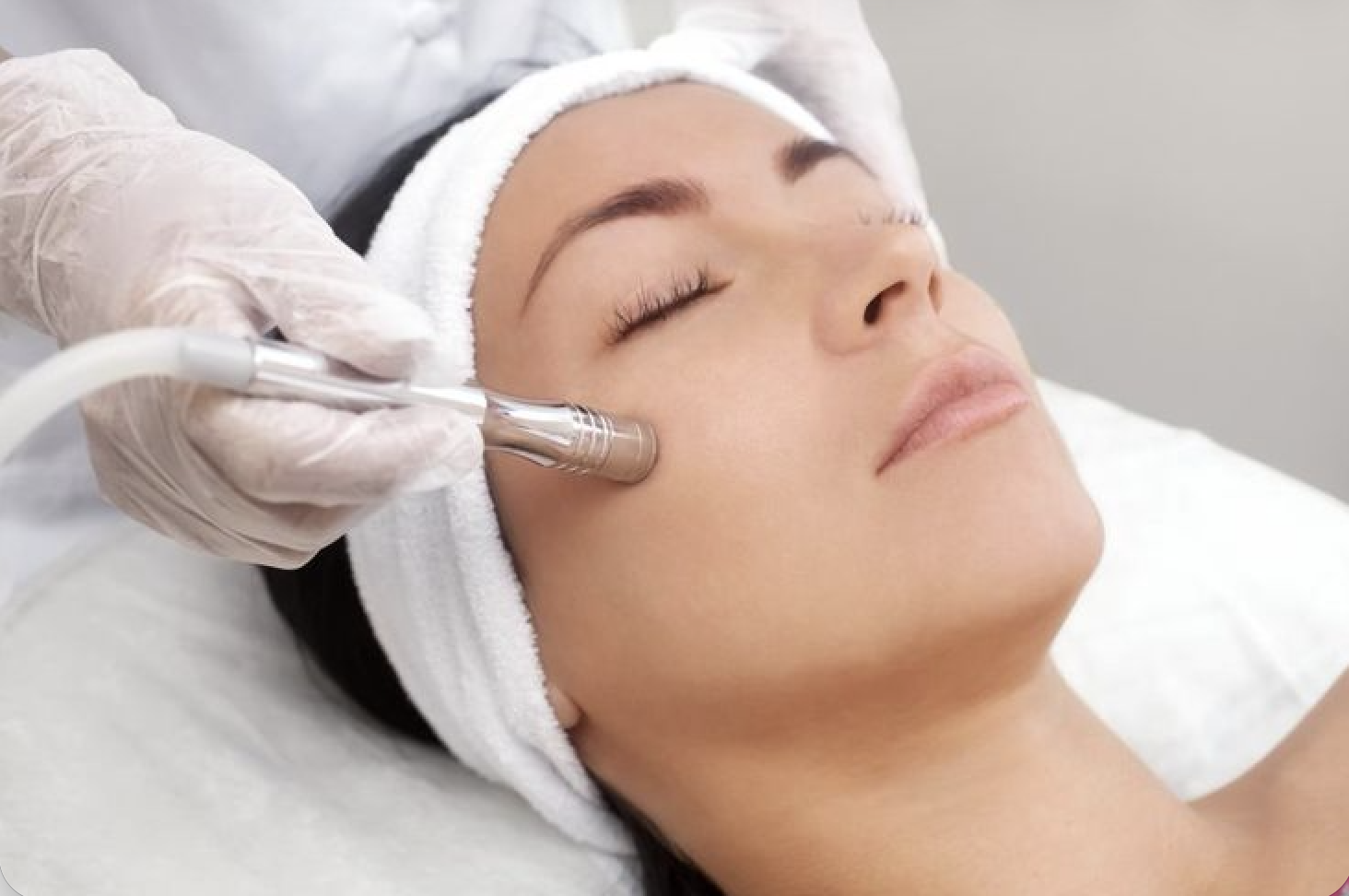 Diamond Microdermabrasion Facial