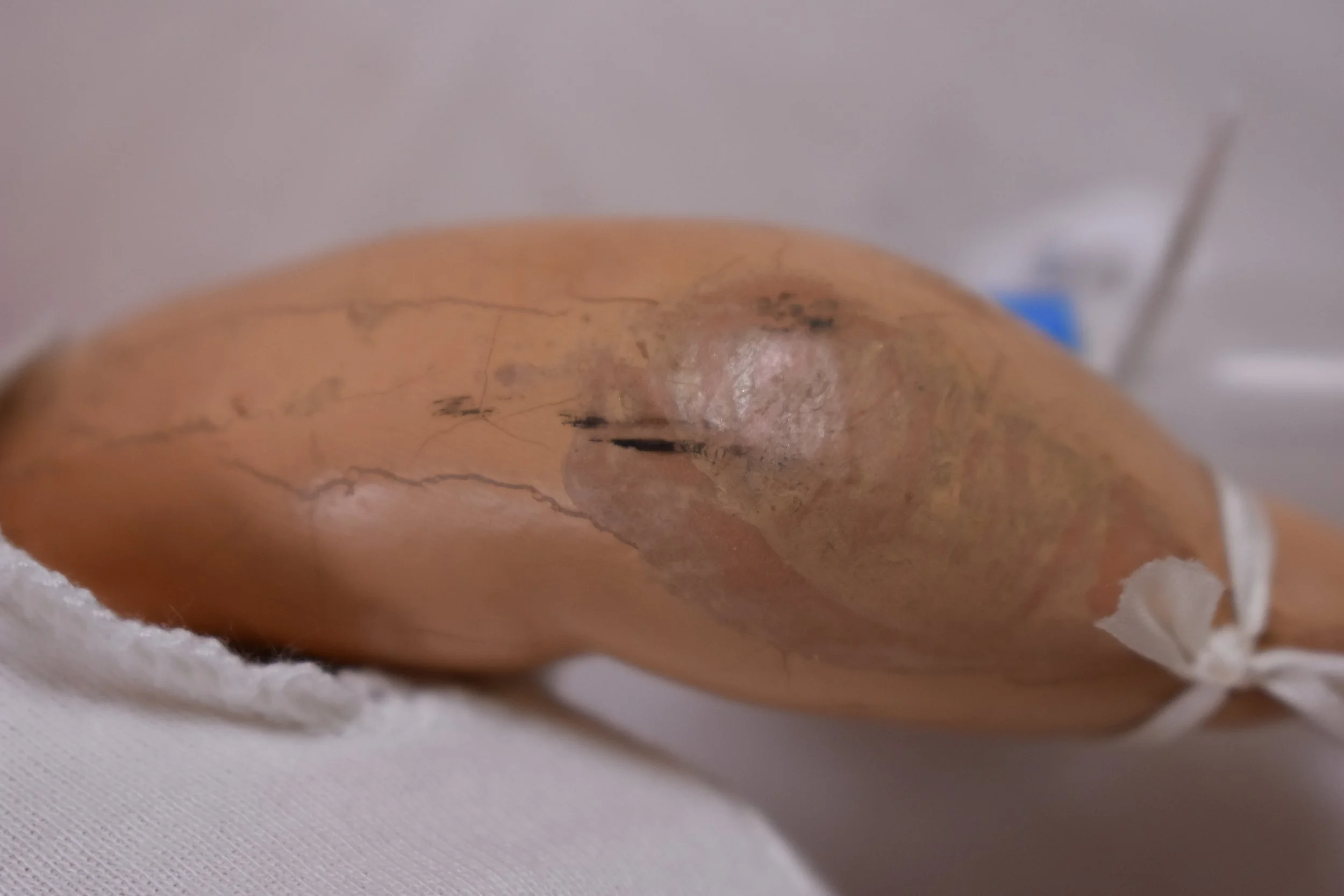 A close-up of water damage to Wettum's leg.