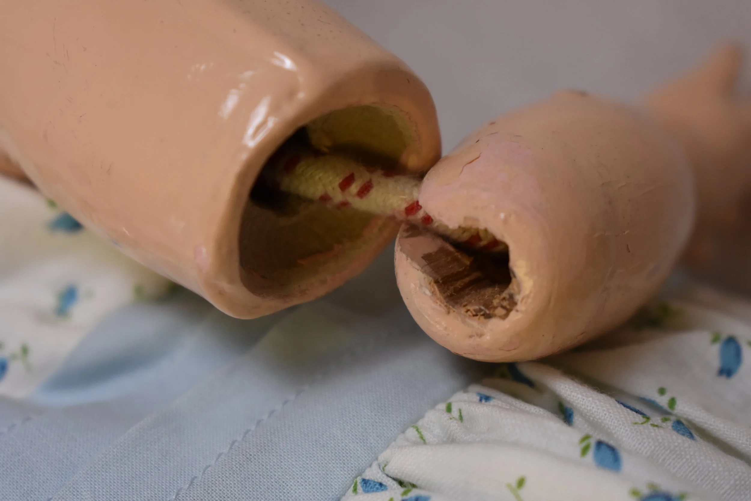 This image shows both the composition body material, as well as the ball and socket joint and its ligature. 